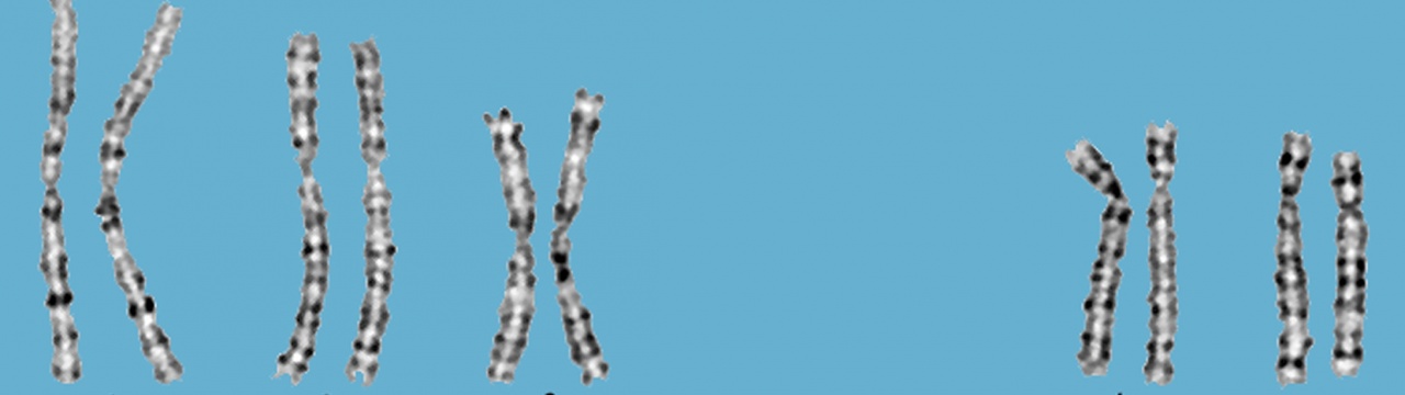 Ein Karyogramm mit menschlichen Chromosomen